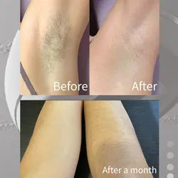 IPL painless Hair Removal Device for Men & Women
